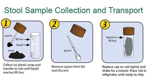 Stool Sample Culture Test: Purpose, Procedure, .